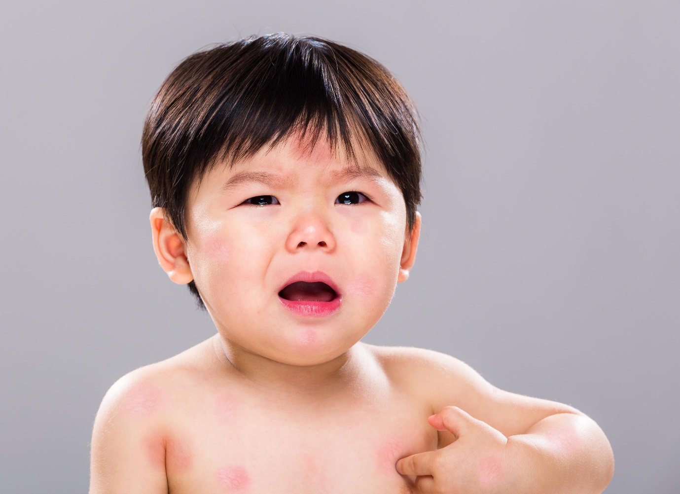 Dị ứng thực phẩm ở trẻ sơ sinh: Nhìn nhận đúng khoa học để bảo vệ bé cưng